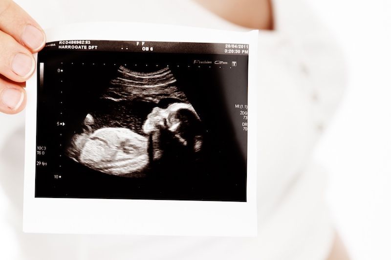ecografía obstetrica gomezroig