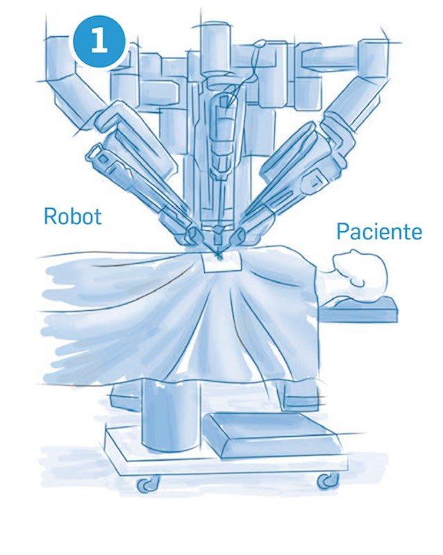 robot cirugia robotica en ginecologia