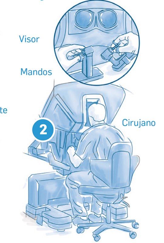 robot y cirujano en cirugia robotica